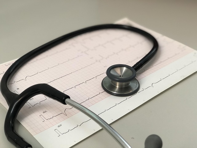 ECG tracing